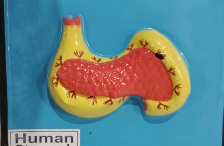 Human Stomach Model